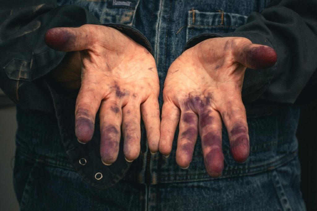 Risks of Lithium-Ion Batteries in the Workplace